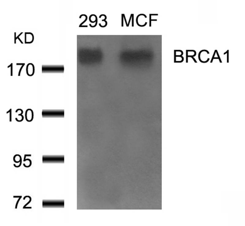 Polyclonal Antibody to BRCA1 (Ab-1524)