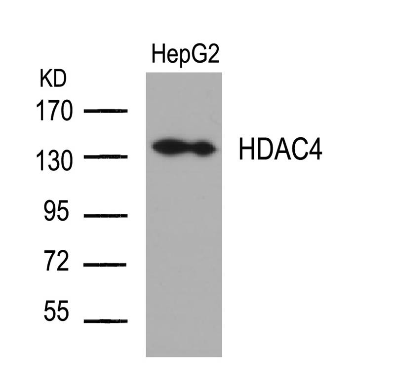 Polyclonal Antibody to HDAC4 (Ab-632)