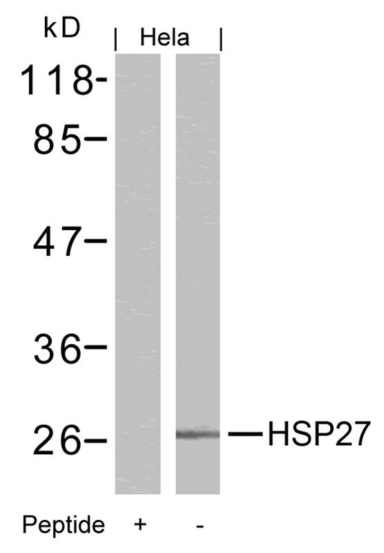 Polyclonal Antibody to HSP27 (Ab-15)