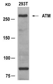 Polyclonal Antibody to ATM (Ab-1981)