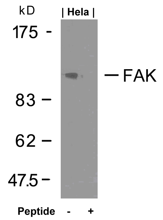 Polyclonal Antibody to FAK (Ab-925)