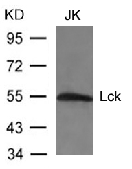 Polyclonal Antibody to Lck(Ab-394)