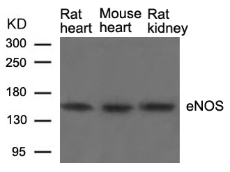 Polyclonal Antibody to eNOS (Ab-1177)