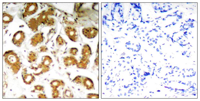 Polyclonal Antibody to NFkB-p65 (Ab-505) (Discontinued)