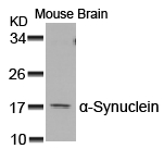 Polyclonal Antibody to  Alpha-Synuclein (Ab-129)