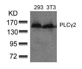 Polyclonal Antibody to PLC Gamma2 (Ab-753)