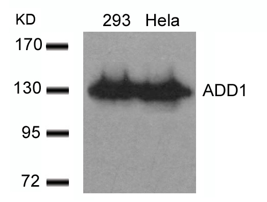 Polyclonal Antibody to ADD1 (Ab-726)