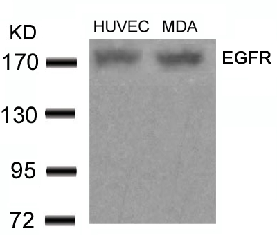 Polyclonal Antibody to EGFR (Ab-678) (Discontinued)