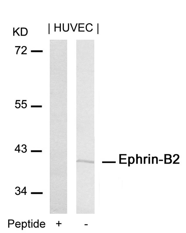 Polyclonal Antibody to Ephrin-B2 (Ab-316)