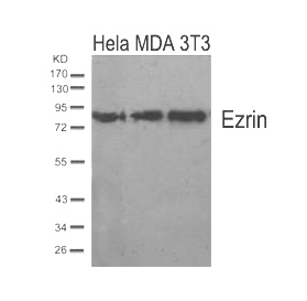 Polyclonal Antibody to Ezrin (Ab-567)