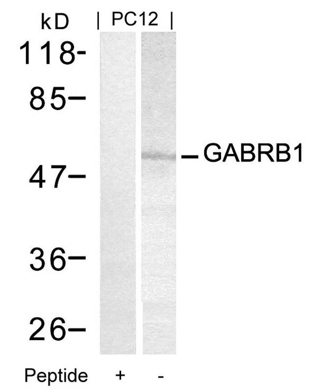 Polyclonal Antibody to GABRB1 (Ab-434)