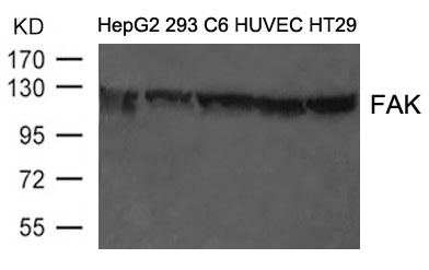 Polyclonal Antibody to FAK (Ab-397)