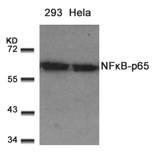 Polyclonal Antibody to NFkB-p65 (Ab-529)