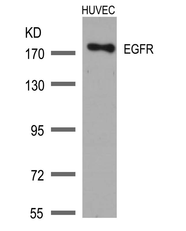 Polyclonal Antibody to EGFR (Ab-1172)