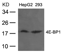 Polyclonal Antibody to 4E-BP1 (Ab-36)