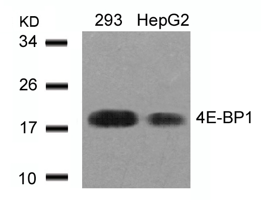 Polyclonal Antibody to 4E-BP1 (Ab-45)