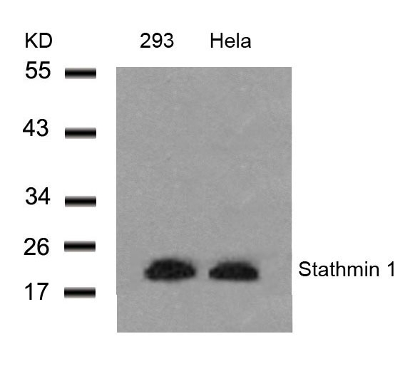 Polyclonal Antibody to Stathmin 1 (Ab-25)