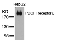 Polyclonal Antibody to PDGF Receptor beta (Ab-751)