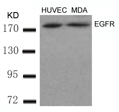 Polyclonal Antibody to EGFR (Ab-869)