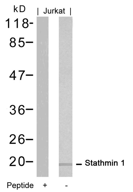 Polyclonal Antibody to Stathmin 1 (Ab-16)