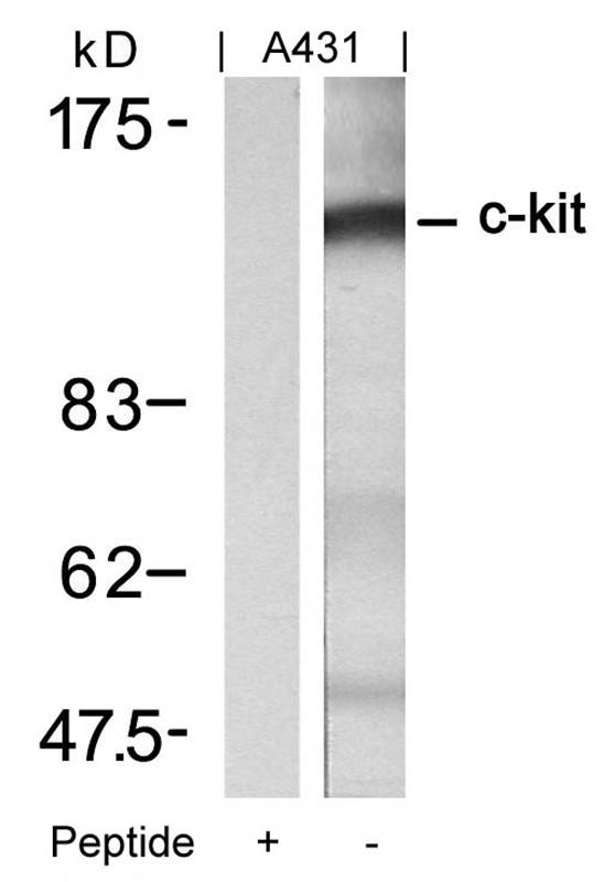 Polyclonal Antibody to c-Kit (Ab-721)