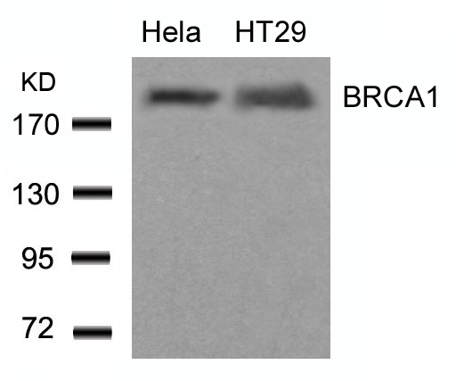 Polyclonal Antibody to BRCA1 (Ab-1423)