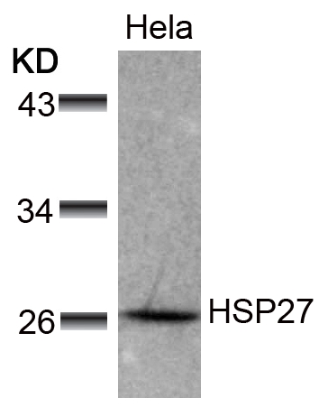 Polyclonal Antibody to HSP27 (Ab-78)