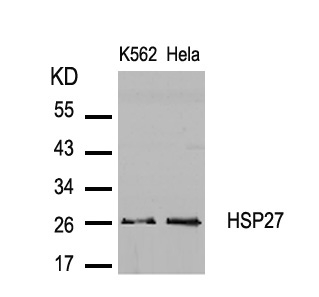 Polyclonal Antibody to HSP27 (Ab-82)