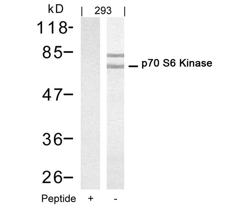 Polyclonal Antibody to p70 S6 Kinase (Ab-421)  (Discontinued)