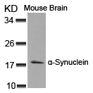 Polyclonal Antibody to  Alpha-Synuclein (Ab-125)