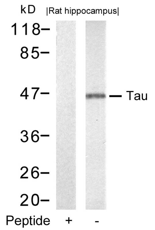 Polyclonal Antibody to Tau (Ab-212)