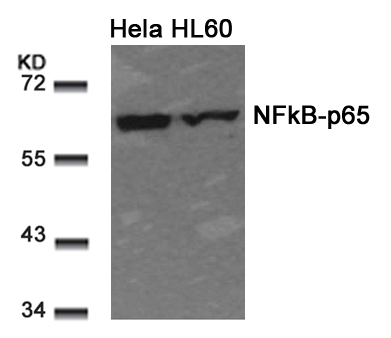 Polyclonal Antibody to NFkB-p65 (Ab-311)