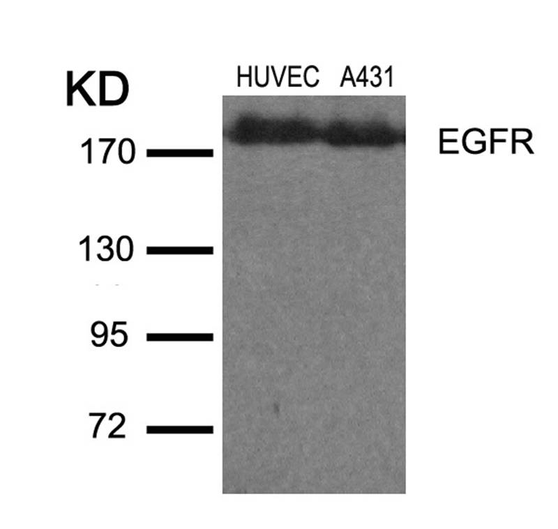 Polyclonal Antibody to EGFR (Ab-1110) (Discontinued)