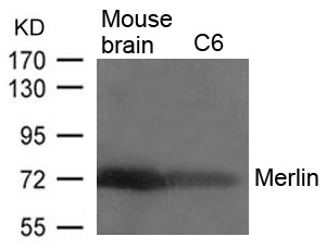 Polyclonal Antibody to Merlin (Ab-518)