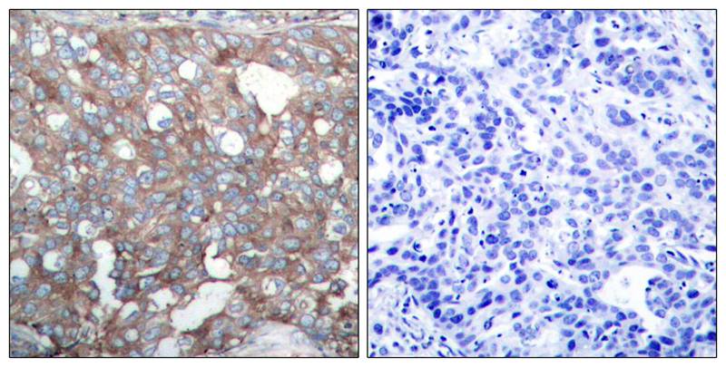 Polyclonal Antibody to Cortactin (Ab-421)