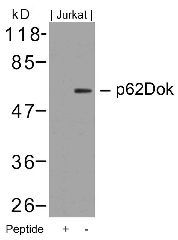 Polyclonal Antibody to p62Dok (Ab-362)