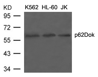 Polyclonal Antibody to p62Dok (Ab-398)