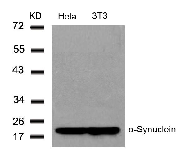 Polyclonal Antibody to  Alpha-Synuclein (Ab-136)