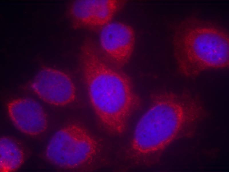 Polyclonal Antibody to CPI17 Alpha (Ab-38)