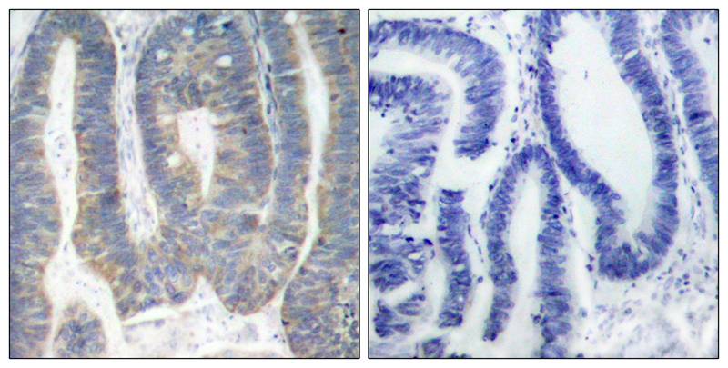 Polyclonal Antibody to PKR (Ab-451)