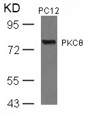 Polyclonal Antibody to PKC Theta (Ab-676)