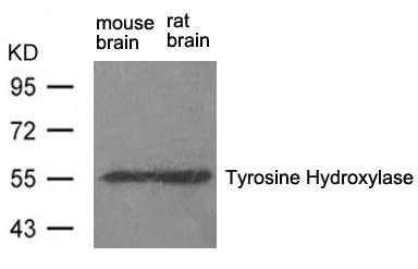 Polyclonal Antibody to Tyrosine Hydroxylase (Ab-31)