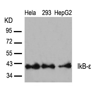 Polyclonal Antibody to IkB-epsilon (Ab-22)