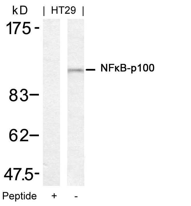 Polyclonal Antibody to NFkB-p100/p52 (Ab-872)