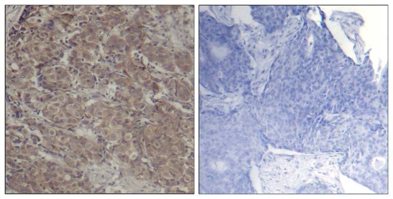 Polyclonal Antibody to CREB (Ab-142)