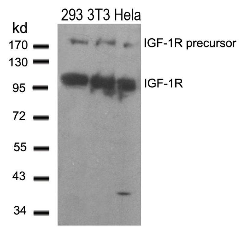 Polyclonal Antibody to IGF-1R (Ab-1280)