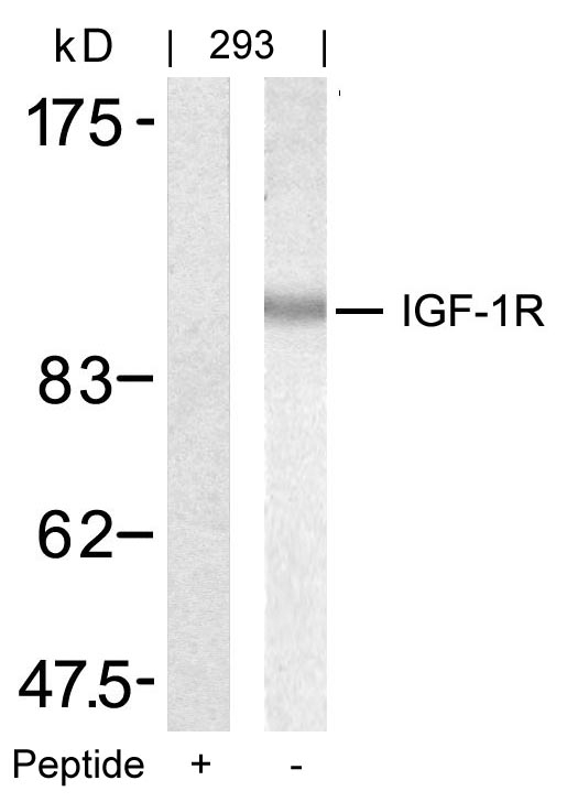 Polyclonal Antibody to IGF-1R (Ab-1346)