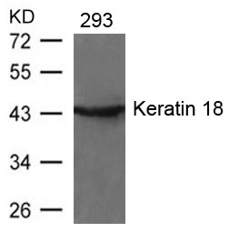 Polyclonal Antibody to Keratin 18 (Ab-33)