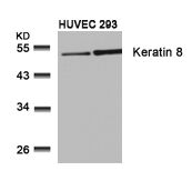 Polyclonal Antibody to Keratin 8 (Ab-74)