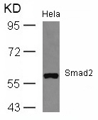 Polyclonal Antibody to Smad2 (Ab-467)